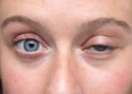 ¿Por qué «titila» el ojo? un doctor explicó las verdaderas causas de este molesto síntoma