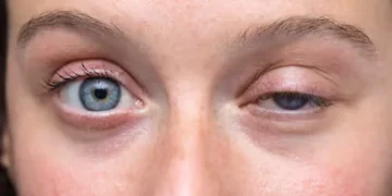 ¿Por qué «titila» el ojo? un doctor explicó las verdaderas causas de este molesto síntoma