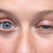 ¿Por qué «titila» el ojo? un doctor explicó las verdaderas causas de este molesto síntoma